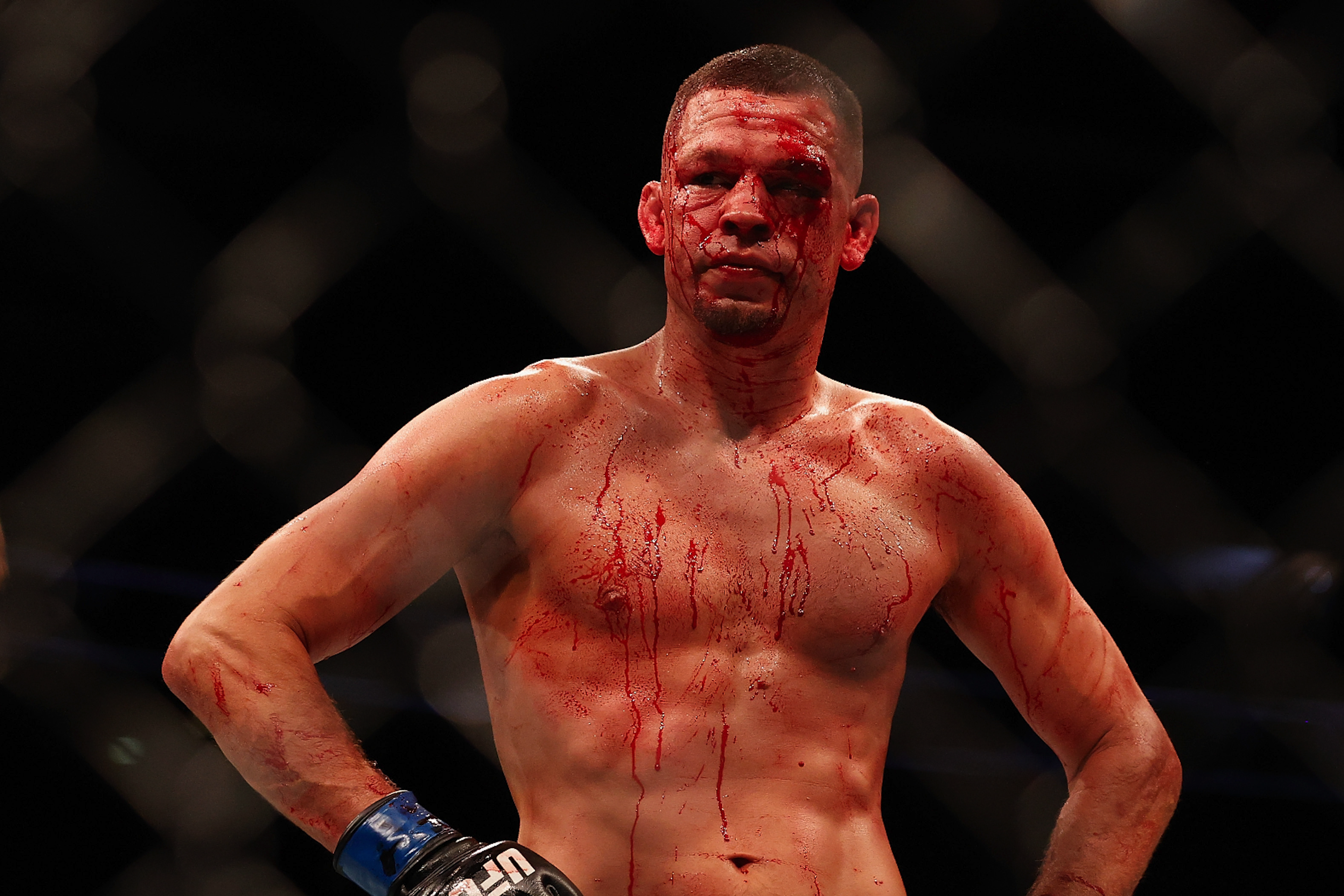 Nate Diaz